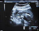 scan